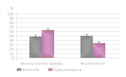 Bild Regedent hyaDENT Produkt Vorteile