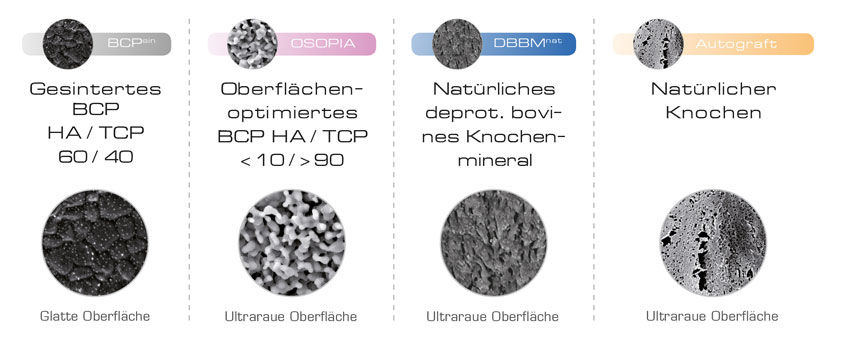 Bild Regedent OSOPIA Technologie