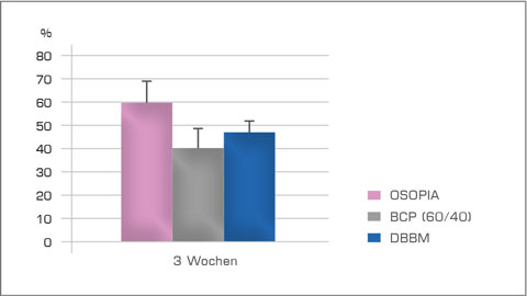Bild Regedent OSOPIA Vorteile