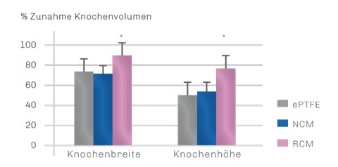 Bild OSSIX PLUS Vorteile