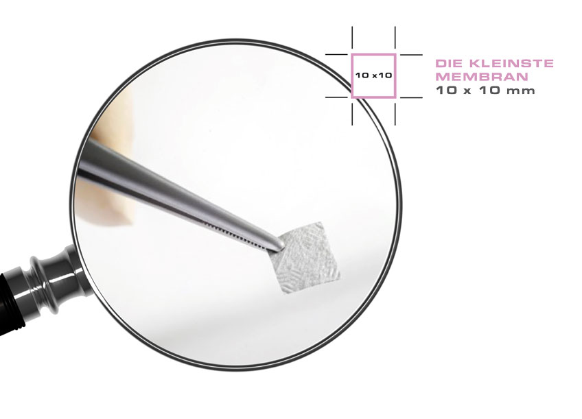 Bild SMARTBRANE Produkt