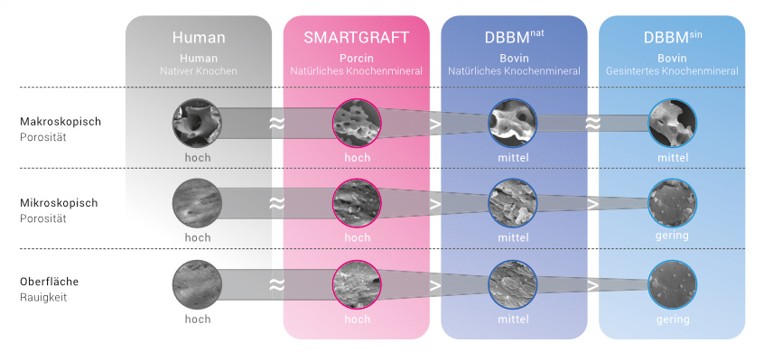 Regedent SMARTGRAFT Technologie