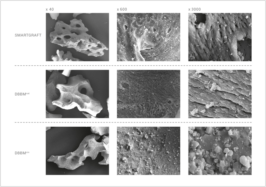 Regedent SMARTGRAFT Vorteile