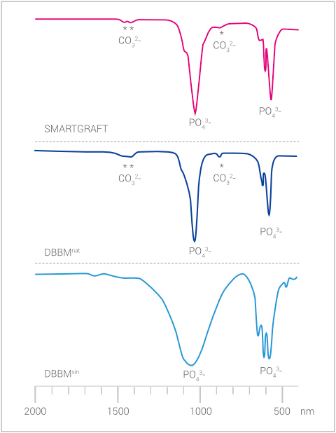 Regedent SMARTGRAFT Produkt Vorteile