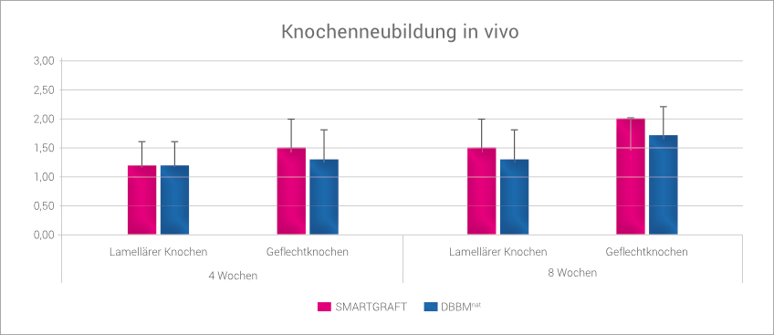 Regedent SMARTGRAFT Produkt Vorteile
